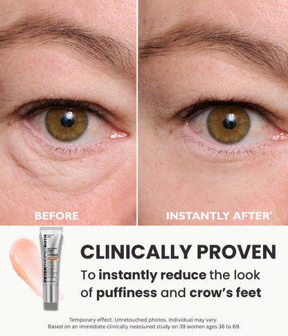 FIRMx Eye Tightener - BRAND NEW 2025 FORMULA