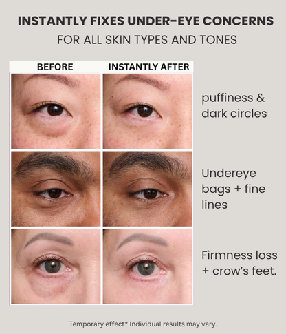 FIRMx Eye Tightener - BRAND NEW 2025 FORMULA